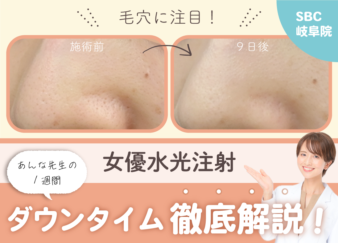 【毛穴・美肌ケア】女優水光注射の効果を岐阜院が検証！ダウンタイム1週間のリアルレポート✨